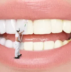 Sứ Emax Press