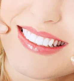 SỨ HT-SMILE